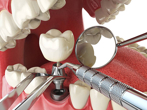 Best Pediatric Emergency Dentist in Sycamore, IL